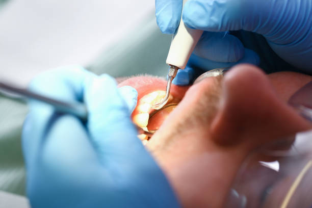 Best Emergency Cosmetic Dentistry in Menlo Park, CA