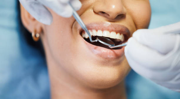 Best Emergency Root Canal Treatment in Menlo Park, CA